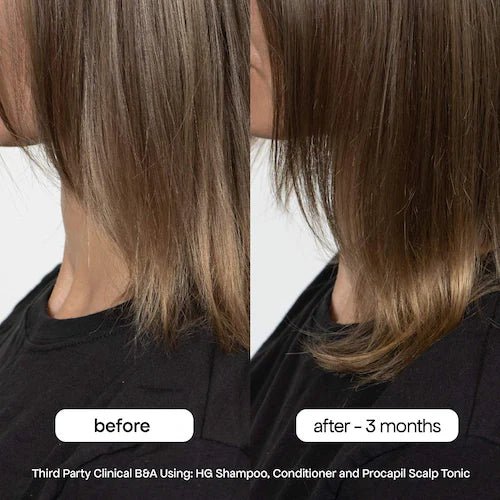 BondiBoost HG Shampoo for Thinning Hair with Rosemary - Kedem Herbs Canada