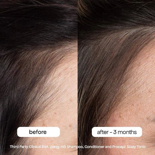 BondiBoost HG Shampoo for Thinning Hair with Rosemary - Kedem Herbs Canada